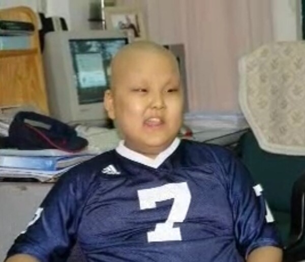  ▲‘횡문근육종’이라는 희귀 소아암으로 치료를 받아오던 이도열 전도사의 투병 당시 어린 시절.ⓒ데일리굿뉴스